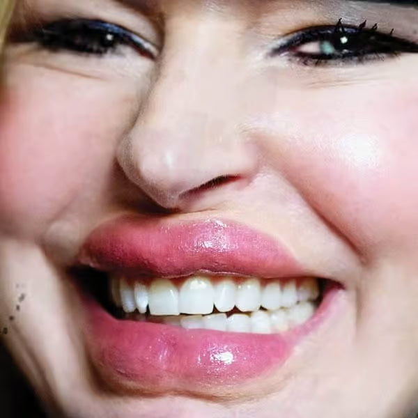 Lip/Tuck – 3D FX Transfers